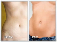 weight loss discovery